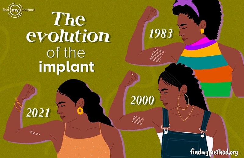 A History Of The Contraceptive Implant