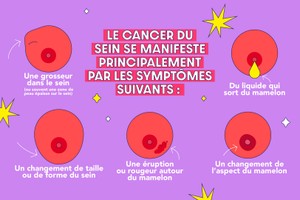 symptômes du cancer du sein