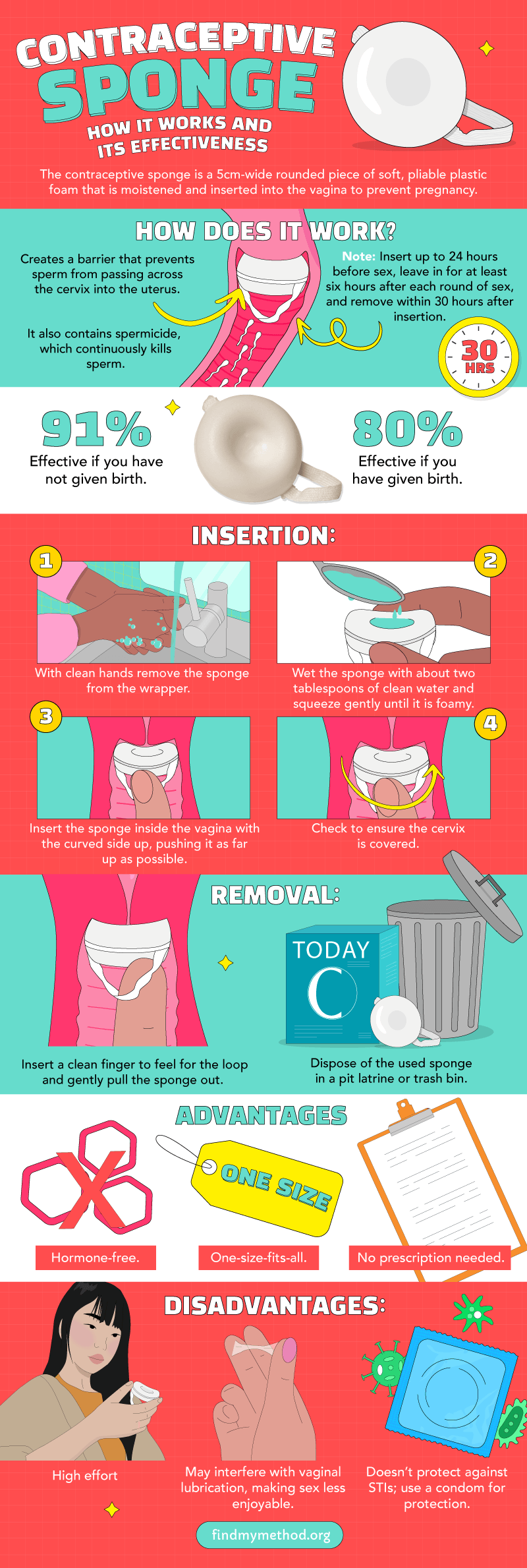 Key facts about the contraceptive sponge, including usage and effectiveness